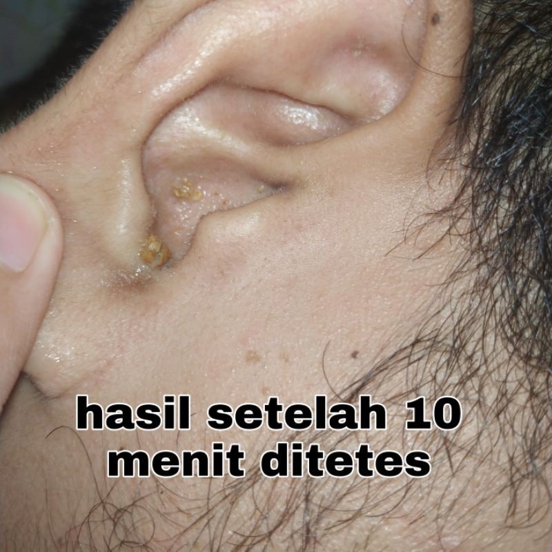 Biofresh Earcare 4