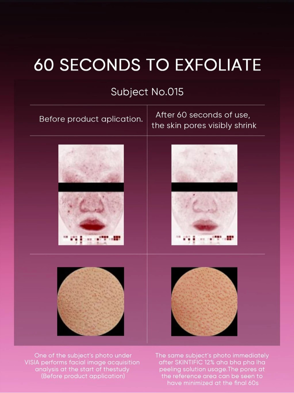 SKINTIFIC Cosmetics SKINTIFIC 12% AHA BHA PHA LHA Peeling Solution