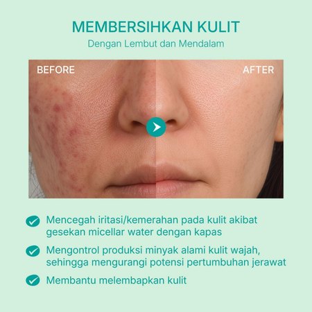 Deep Cleanse Oil Cleanser 3
