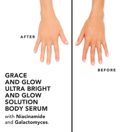 Grace And Glow Bright and Glow Body Serum with Niacinamide + Galactomyces 4