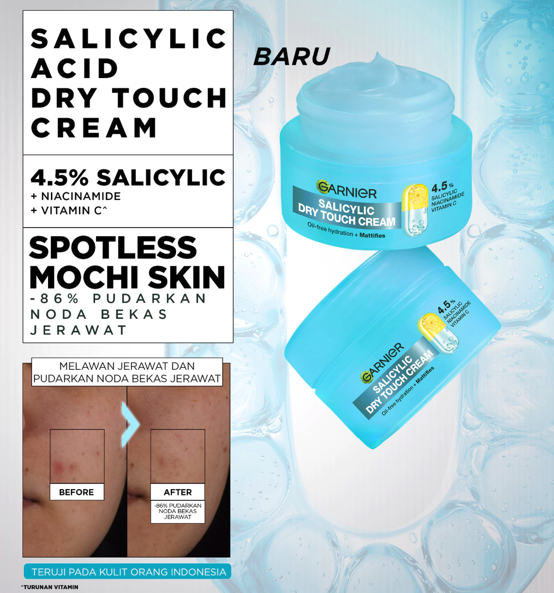 L’Oréal Garnier Salicylic Dry Touch Cream