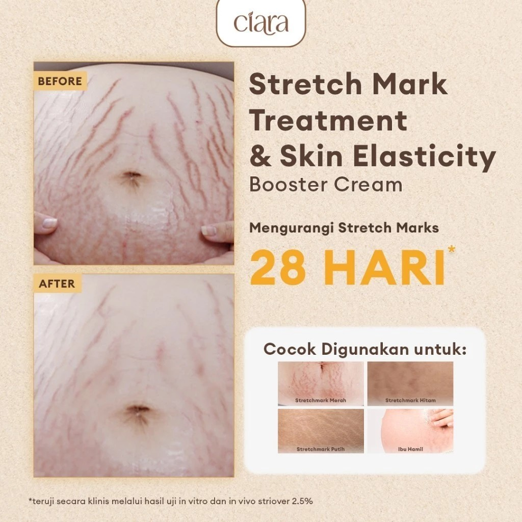 Ciara Indonesia Ciara Stretch Mark Treatment