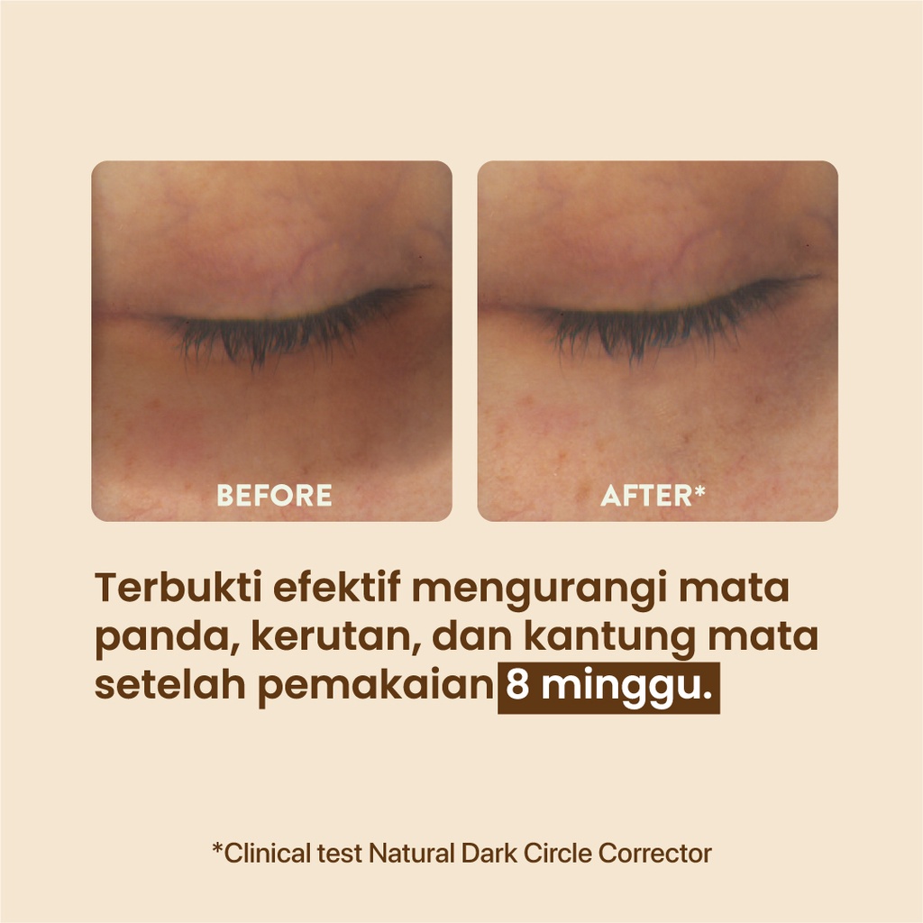 N'Pure Marigold Eyemazing Power Serum Concentrate