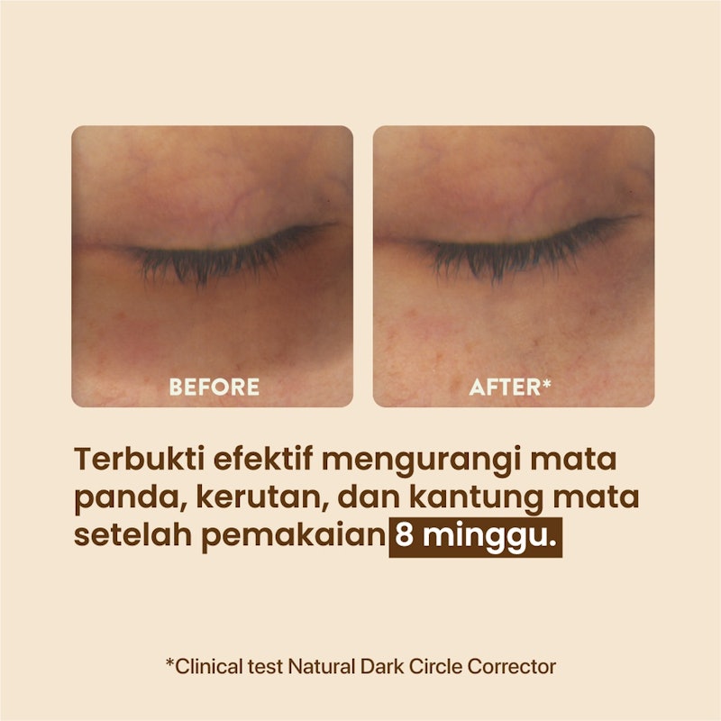Marigold Eyemazing Power Serum Concentrate 5