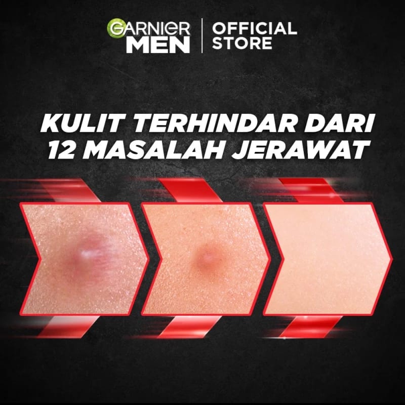 L’Oréal Garnier Men Acno Fight Acne Fighting Brightening Serum Cream