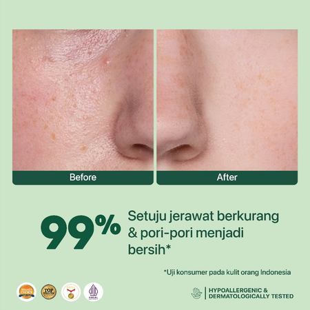 Penta Natural Kosmetindo N'PURE Centella Asiatica Acne Clear Hydrating & Calming Toner