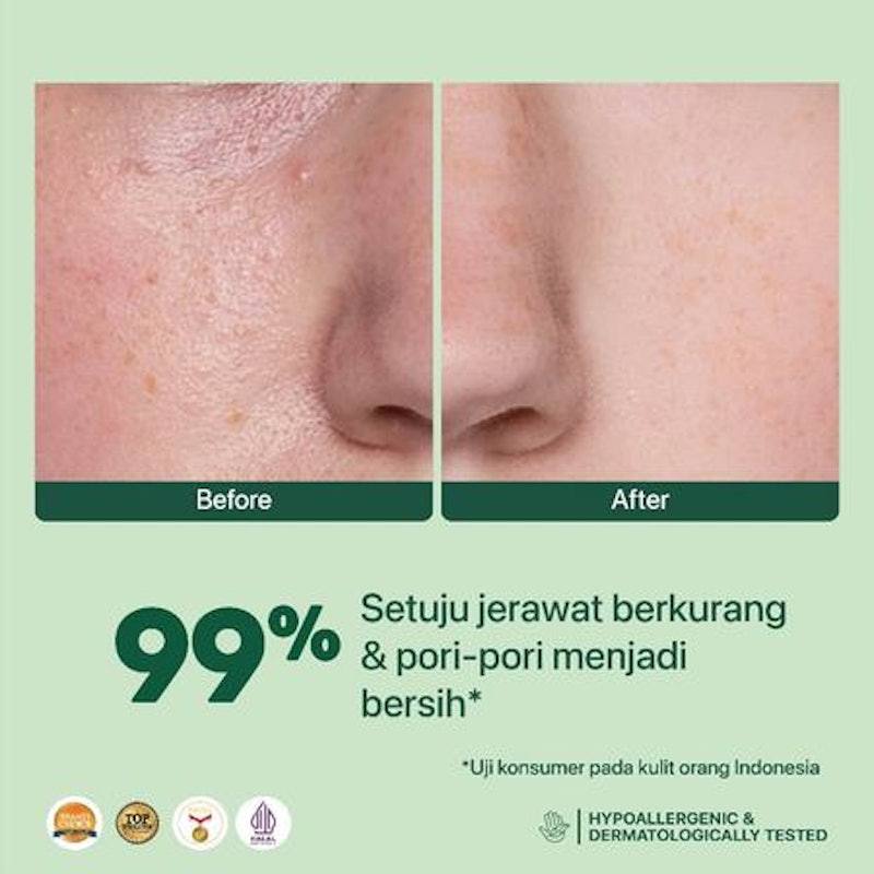 Centella Asiatica Acne Clear Hydrating & Calming Toner 4