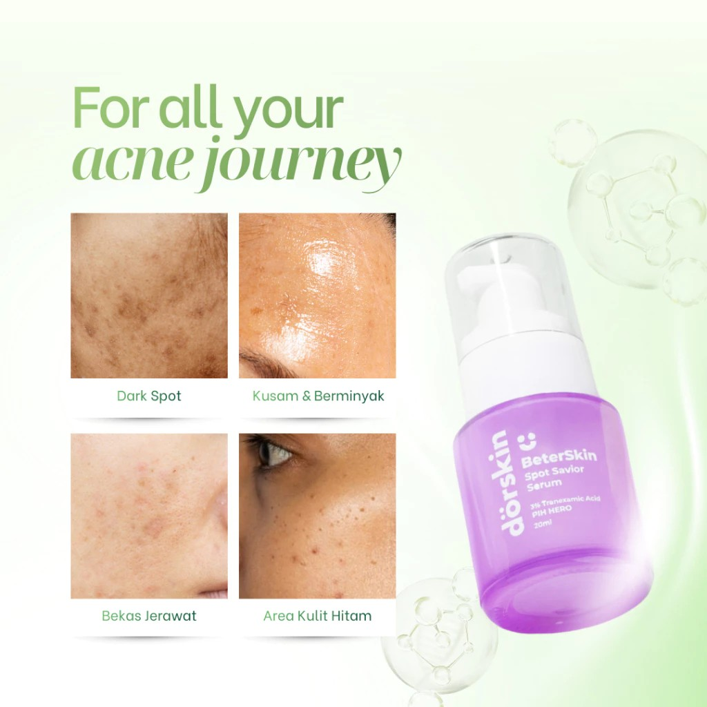 Dörskin BeterSkin Spot Savior Serum 4