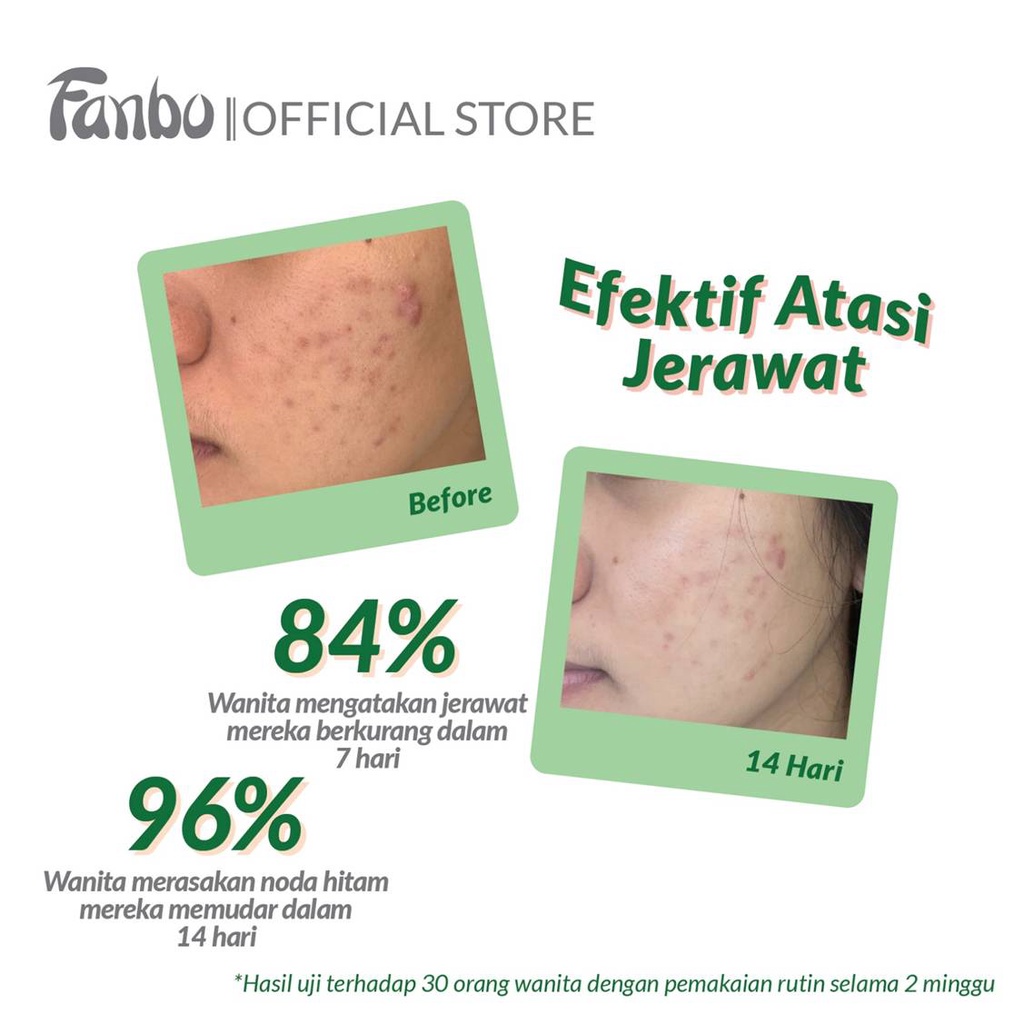 Fabindo Sejahtera Fanbo Acne Rescue Serum
