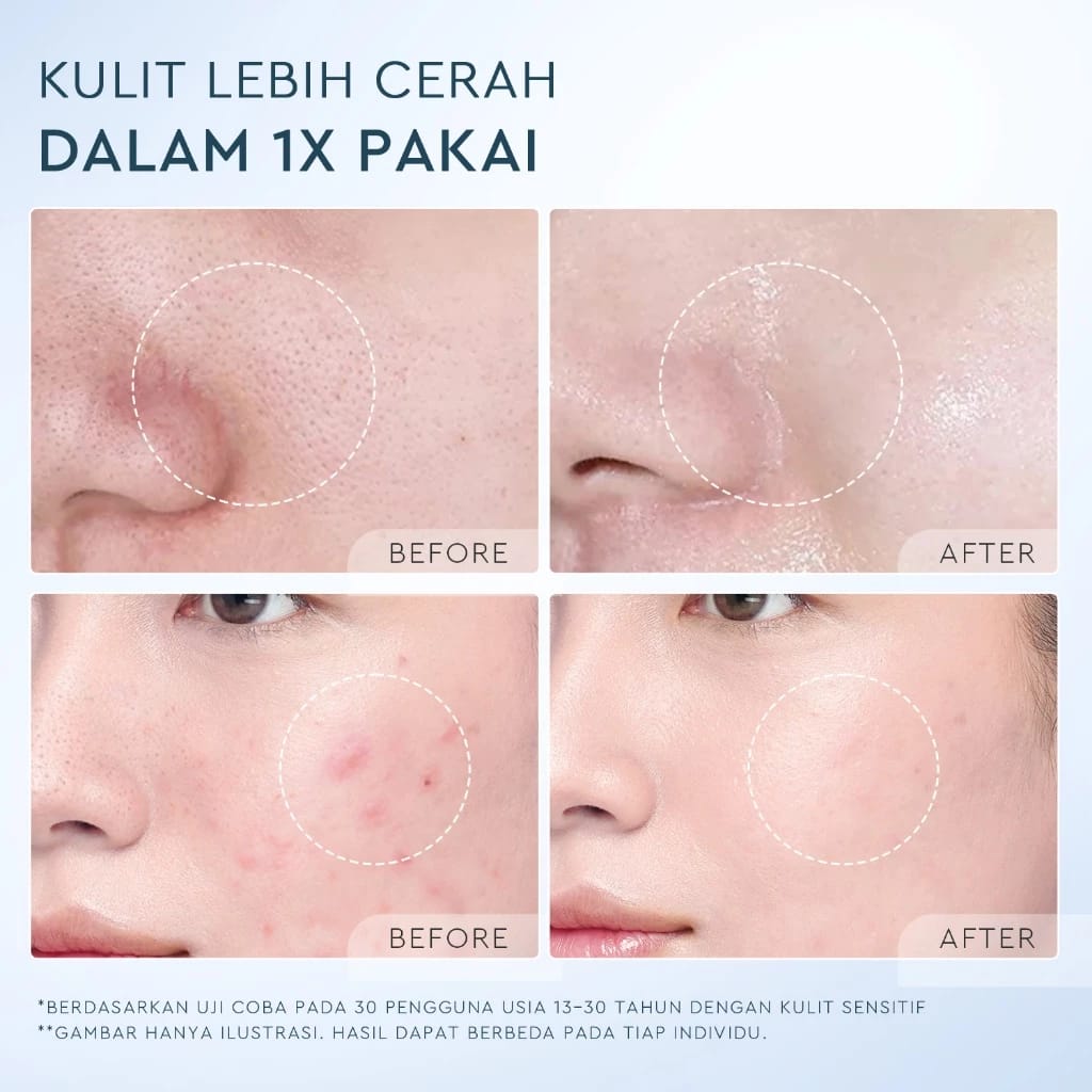 Suntone Wisdom Indonesia Glad2Glow Deep Pore Clean Facial Wash