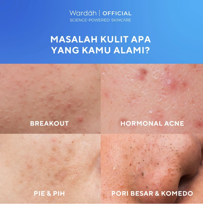 Paragon Technology and Innovation Wardah UV Shield Acne Calming Sunscreen Moisturizer SPF 35 PA+++ 