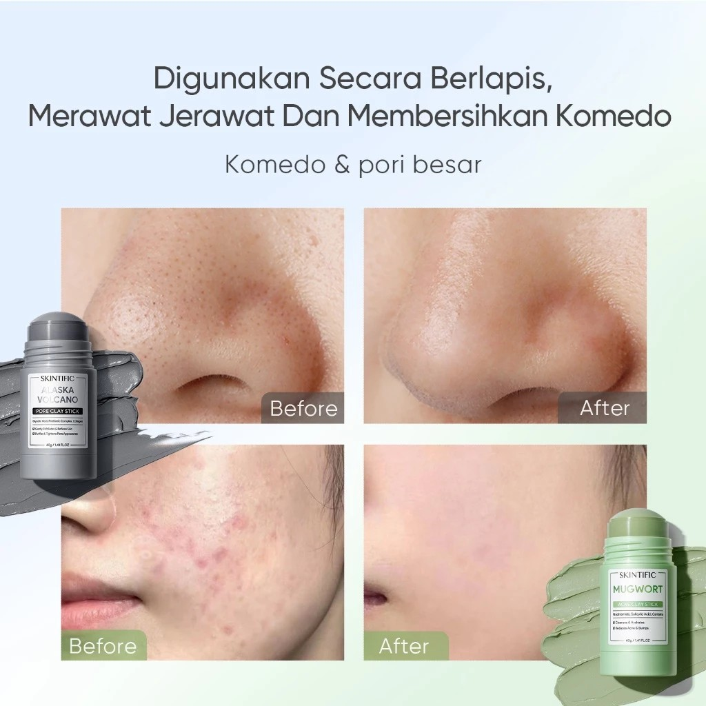 SKINTIFIC Cosmetics SKINTIFIC Mugwort Acne Clay Stick 