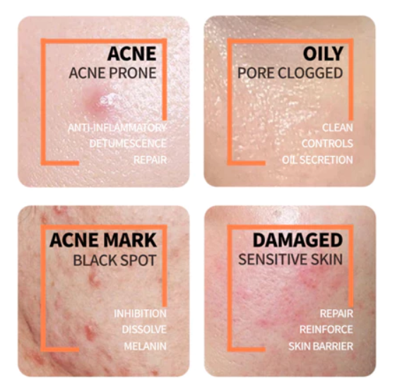 Deciem The Ordinary Niacinamide 10% + Zinc 1%