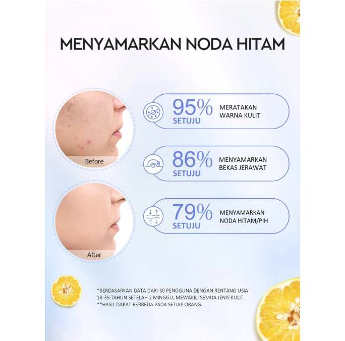 Suntone Wisdom Indonesia Glad2Glow Yuja 377 Dark Spot Moisturizer