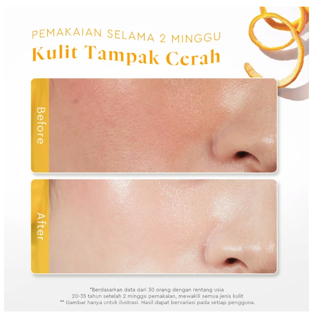 Suntone Wisdom Indonesia Glad2Glow Perfect Vita C Bright Glow Moisturizer