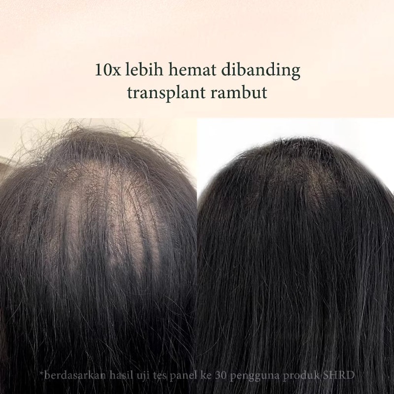 SH-RD Red Ginseng Hair Activating Shampoo 2
