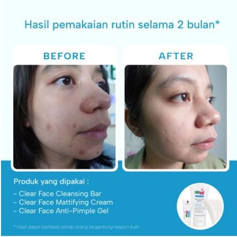 Sebamed Clear Face Anti Pimple Gel 4