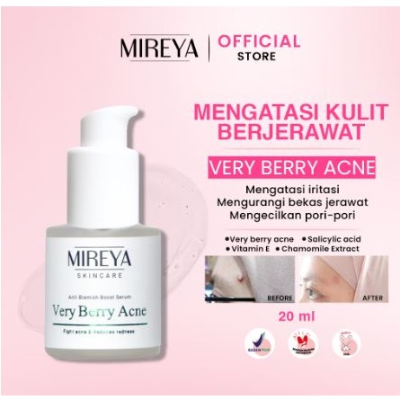 Indokarisma Parvaiz Makmur Mireya Very Berry Acne Anti Blemish Boost Serum