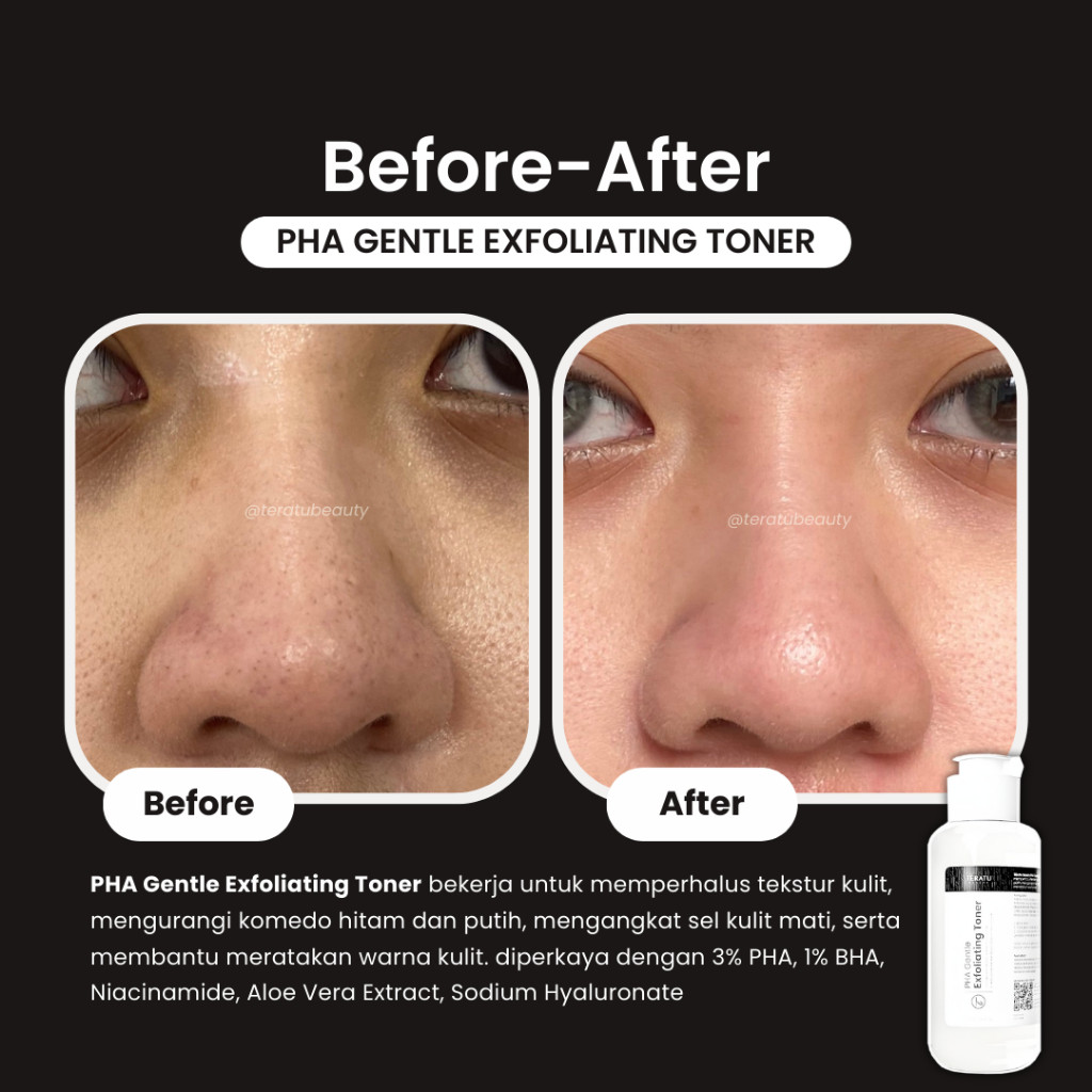 Fandi Universal Kosmekreasi Tératu Beauty Teratu Beauty PHA Gentle Exfoliating Toner