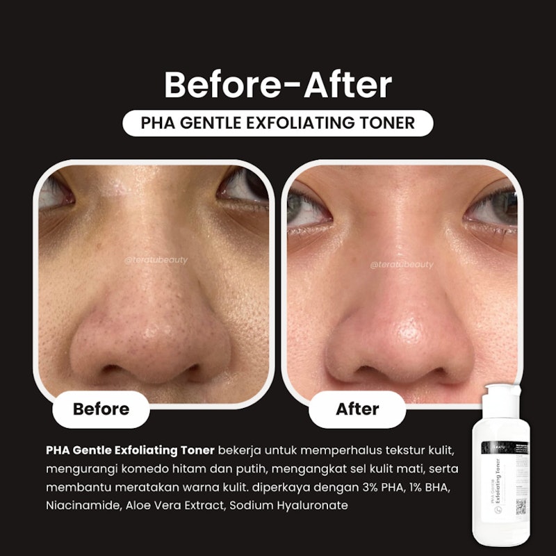 Teratu Beauty PHA Gentle Exfoliating Toner 4