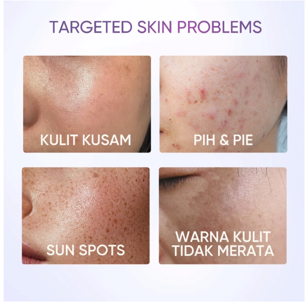 SKINTIFIC Cosmetics SKINTIFIC Symwhite 377 Dark Spot Moisture Gel 