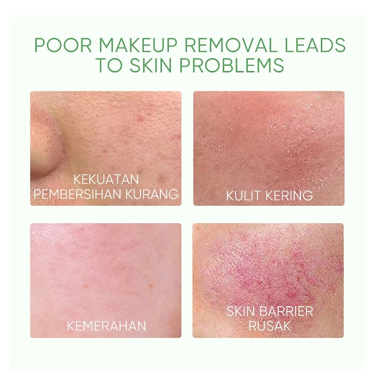 SKINTIFIC Cosmetics SKINTIFIC Mugwort Purifying Micellar Water