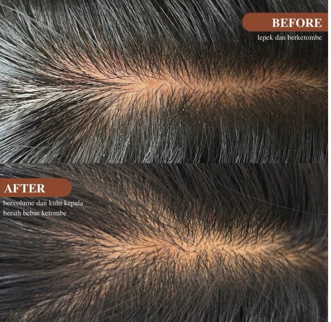 Heritier Indonesia Heritier Reconstruct Scalp and Hair Mask