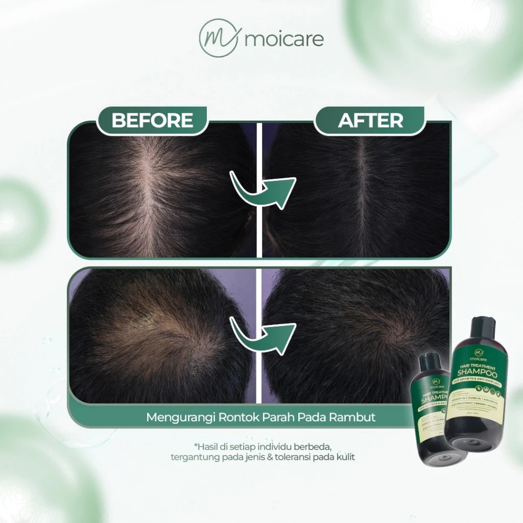 Moicare Hair Treatment Shampoo