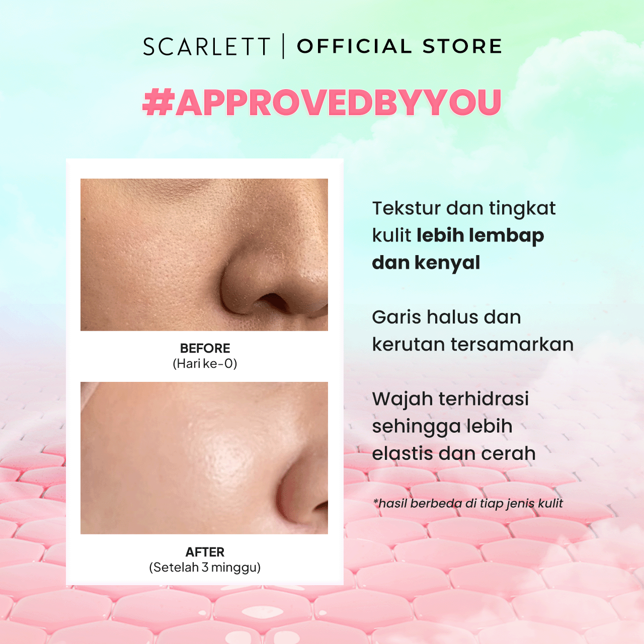 Opto Lingkar Sejahtera Scarlett Whitening 7X Ceramide Barrier Up