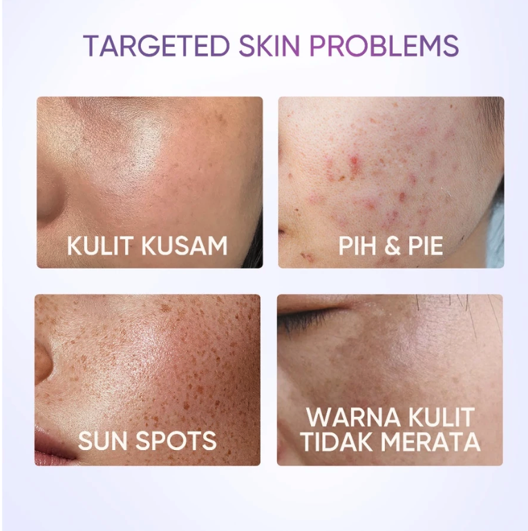 SKINTIFIC Cosmetics SKINTIFIC Symwhite 377 Dark Spot Moisture Gel 