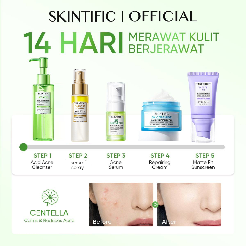 SKINTIFIC Cosmetics SKINTIFIC 5PCS Anti Acne Set