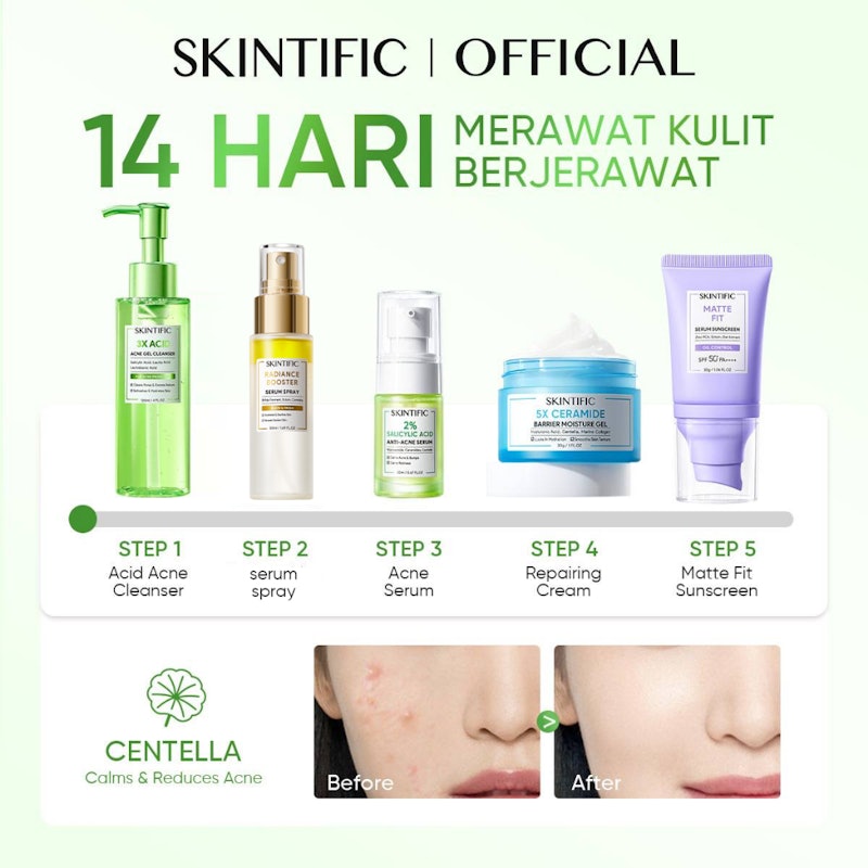 5PCS Anti Acne Set 2