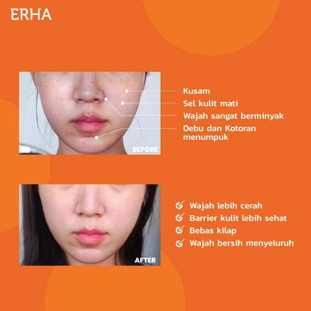 ERHA Clinic Indonesia ERHA Exfoliating Cleansing Scrub