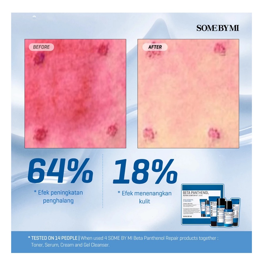 Perennbell SOME BY MI Beta Panthenol Starter Kit 