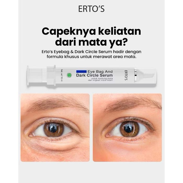 Erto Berjaya International Erto's Eyebag & Dark Circle Serum