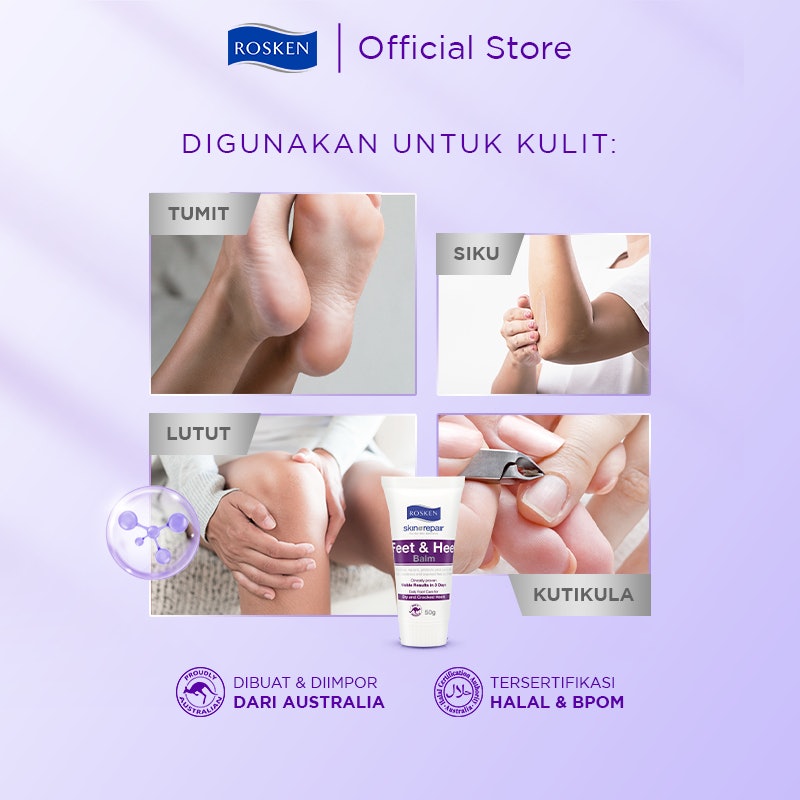 Rosken Feet & Heel Balm 5