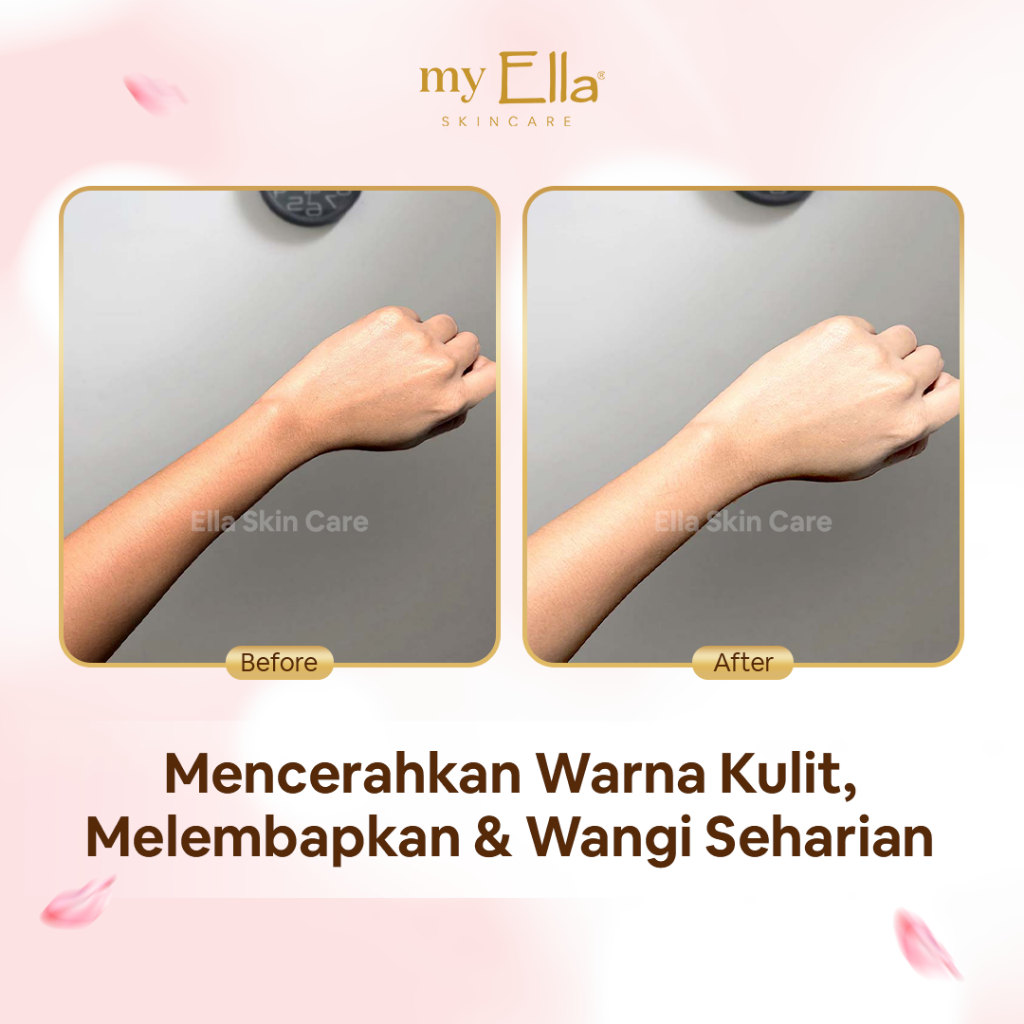Ella Karunia Estetika Ella Skincare Spring Blossom Intensive Brightening Body Serum