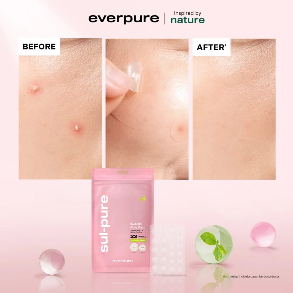Natura Deca Kosmetika Everpure Sul-pure Invisible Acne Patch