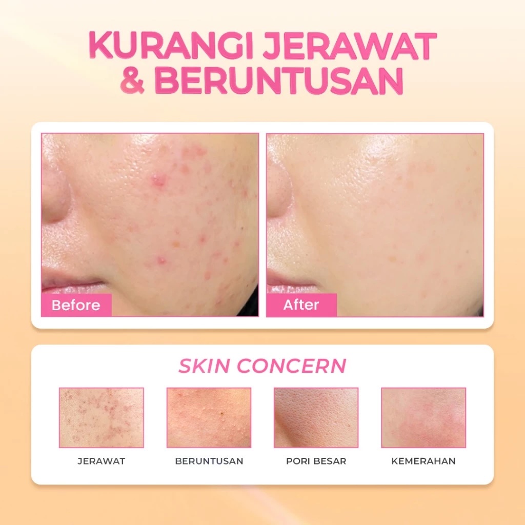 Eka Jaya Internasional Hanasui Power Acne Serum