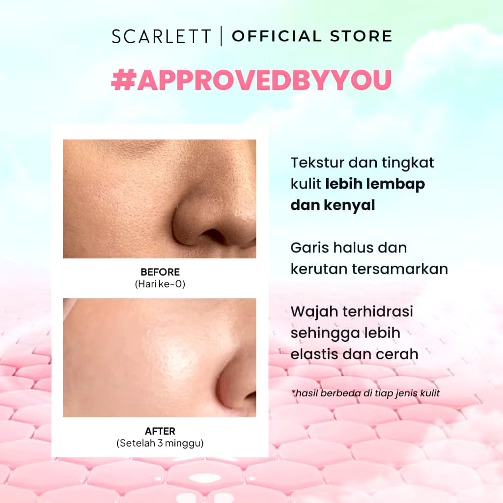 Opto Lingkar Sejahtera Scarlett Whitening 7x Ceramide Barrier Up Moisturizer