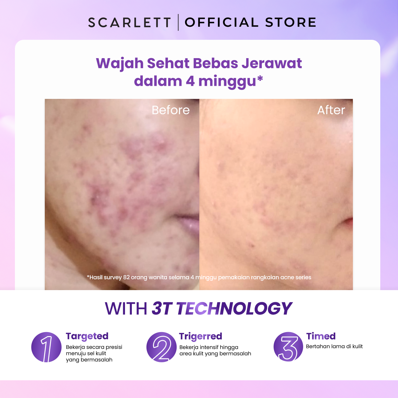 Opto Lingkar Sejahtera Scarlett Whitening Acne Serum