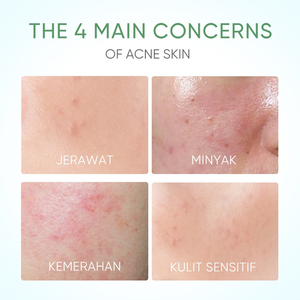 SKINTIFIC Cosmetics SKINTIFIC Pure Centella Acne Calming Toner