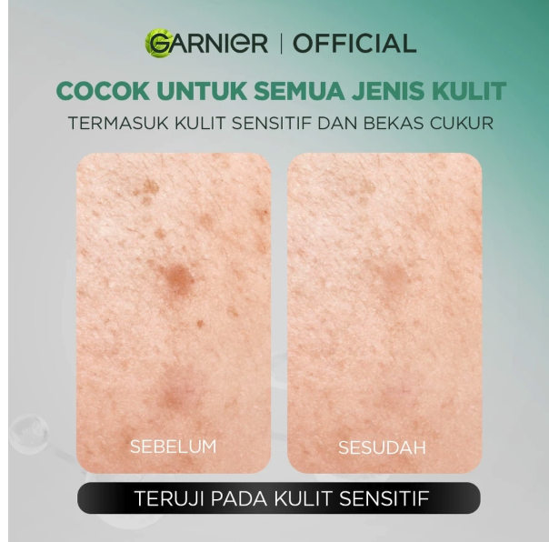 Garnier Men AcnoFight Acne Calming Gentle Gel Cleanser 