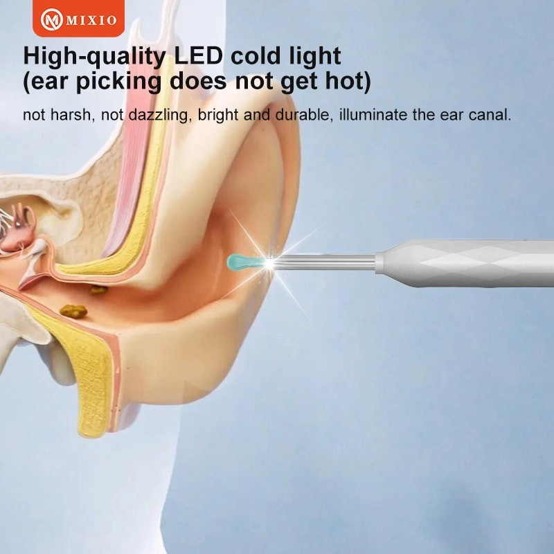 MIXIO Pembersih Telinga Kamera LED Smart Visual Endoscope 4