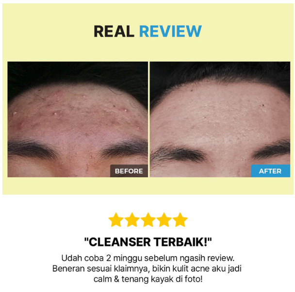 COSRX COSRX AC Low pH Good Morning Gel Cleanser