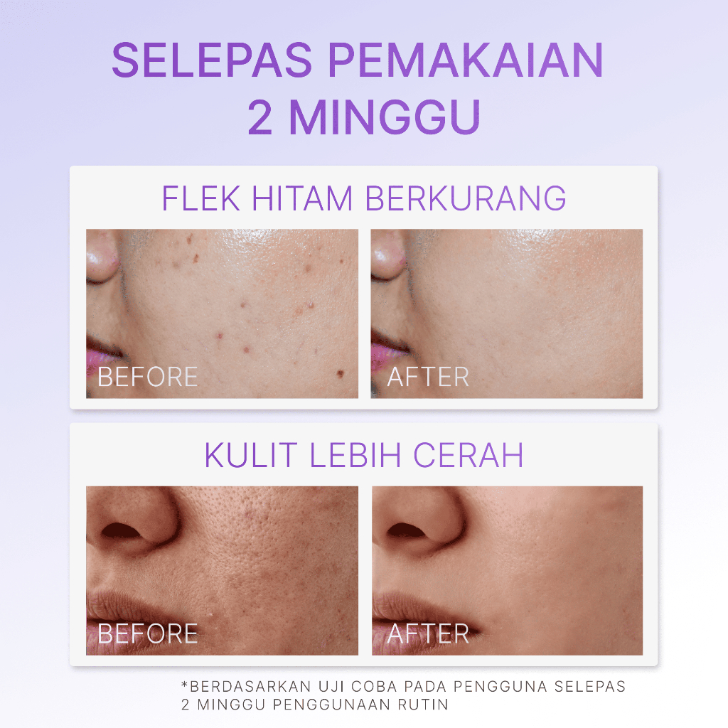 Ozzaskin Cantik Muda Alami Ozzaskin Ultimate Night Cream Dark Spot Skincare