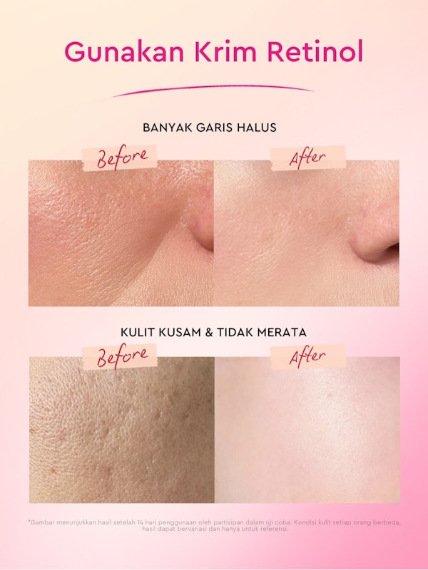 Glad2Glow Peach Retinol Moisturizer 5