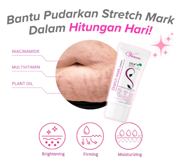 Cakra Daya Makmur Vienna Stretch Mark Cream