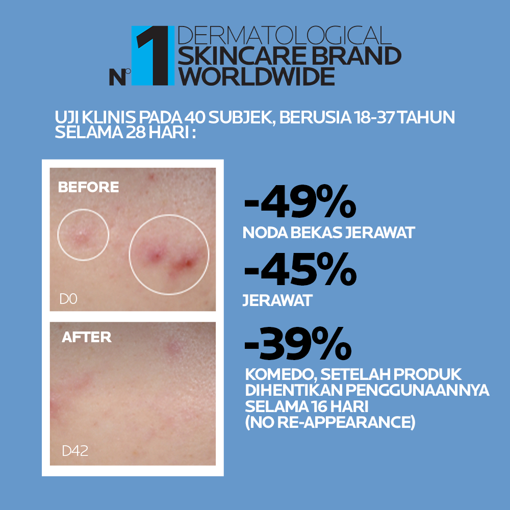 L’Oréal La Roche-Posay Effaclar Salicylic Acid Serum