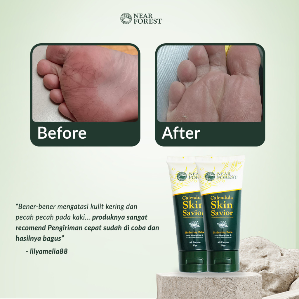 Near Forest Near Forest Calendula Skin Savior